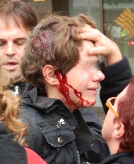 Niño herido en Tarragona
