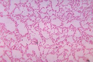 Sin las enzimas de las Bacteroides, los humanos no podrían digerir bien lso carbohidratos. Wikipedia