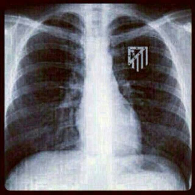 radiografia_escudo_Atleti